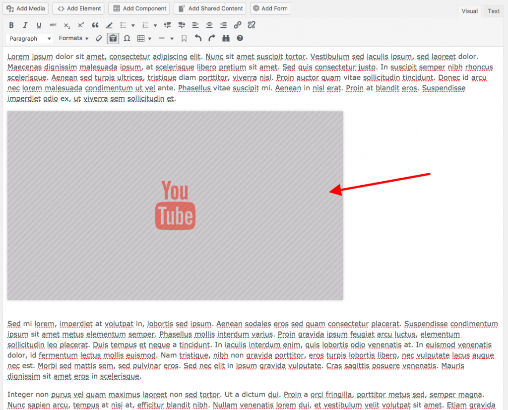 Image showing the youtube video placeholder