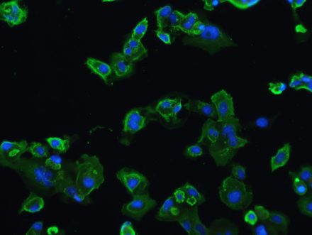 Virus-infected HT-1080 cancer cells taken by Alex Roberts using immunofluorescence staining.